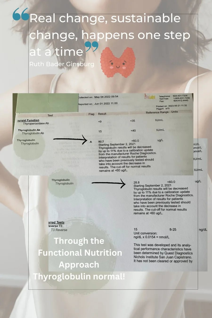 Thyroid bloodwork after dietary and metabolic changes